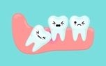 در چه شرایطی می توان دندان عقل را نکشید؟